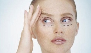 a blepharoplasztika típusai a szem körüli bőr fiatalítására